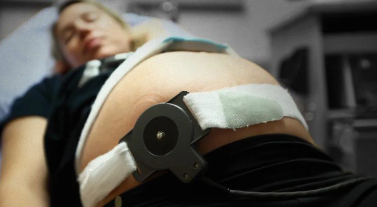 When is fetal heart rate monitoring necessary?