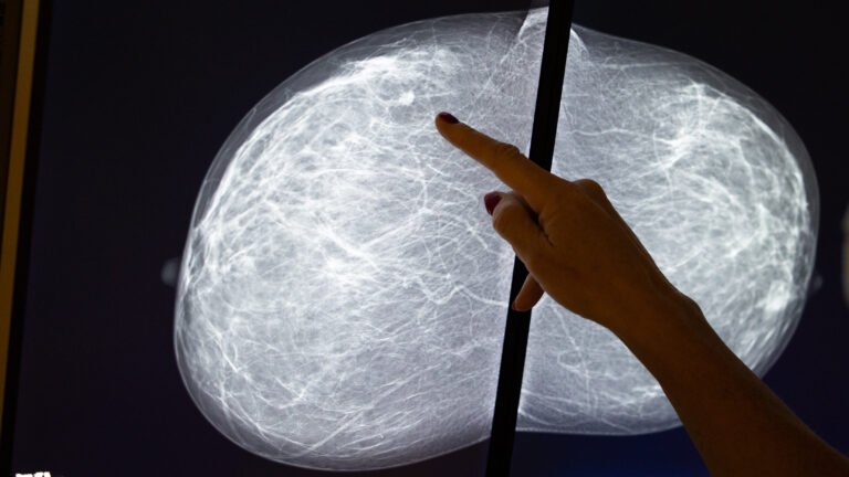 Does breast density matter for older women’s risk of cancer?