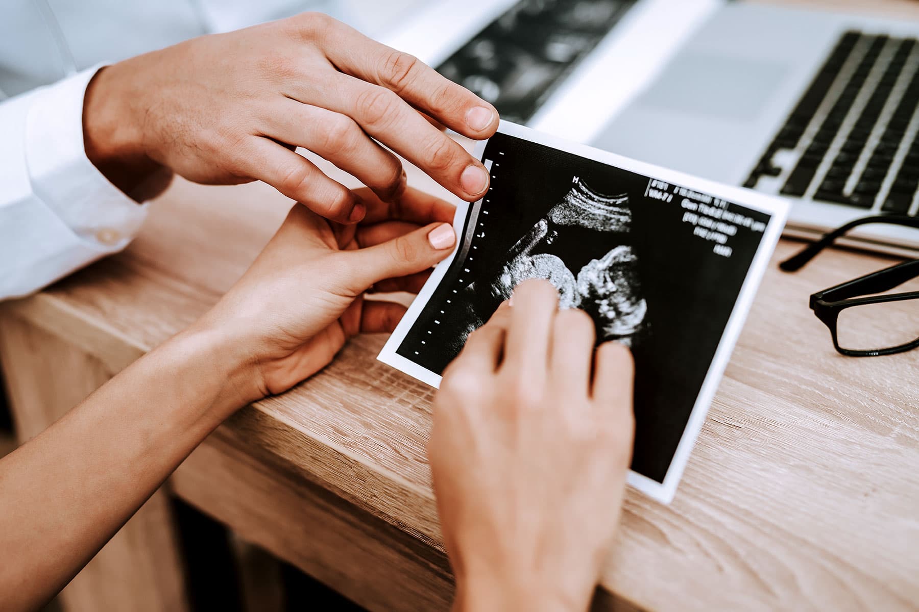Ultrasound Imaging Ultrasound Imaging