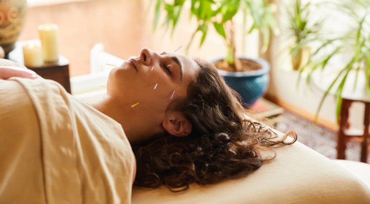 Should You Try Acupuncture for Morning Sickness?