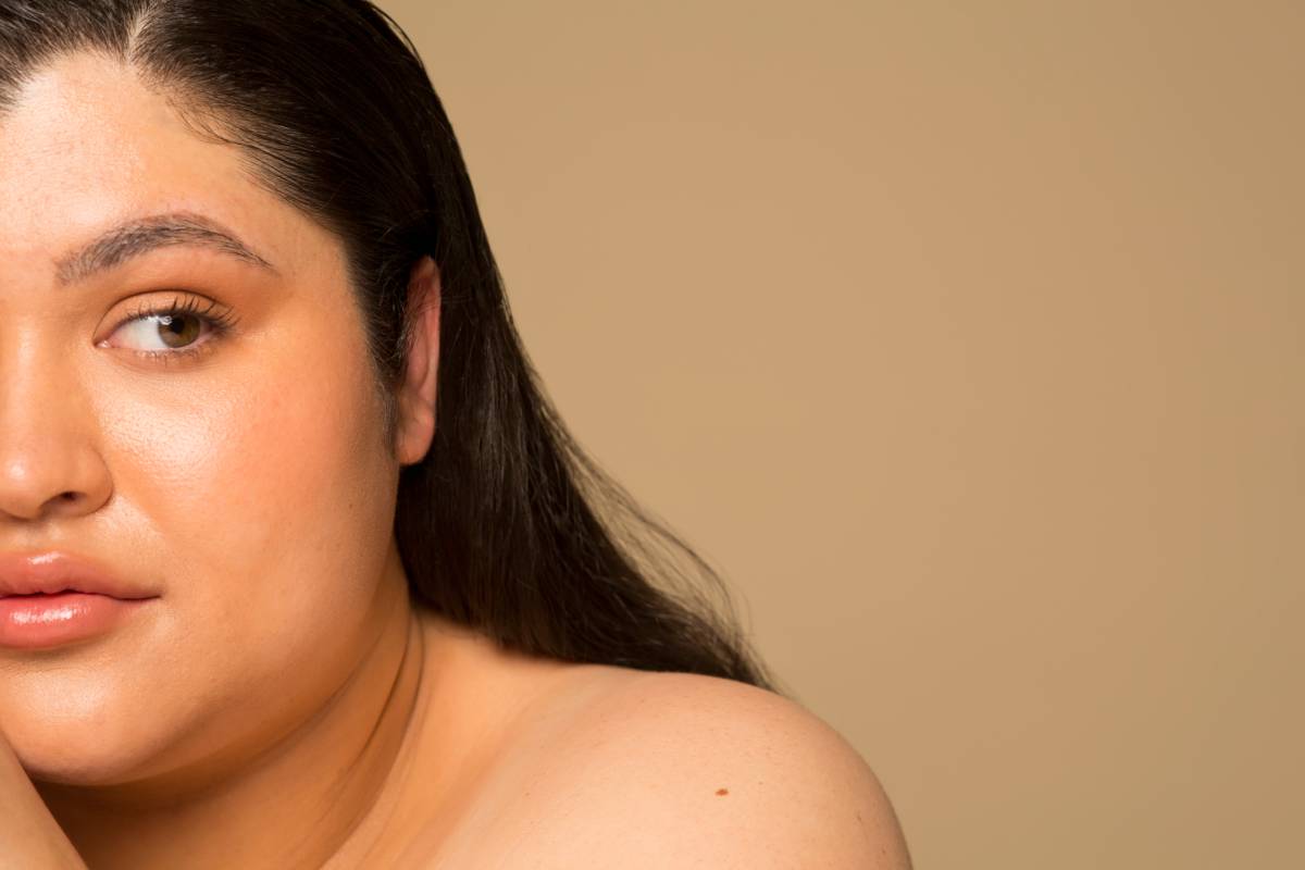 Polycystic Ovary Syndrome (PCOS) – What You Need to Know